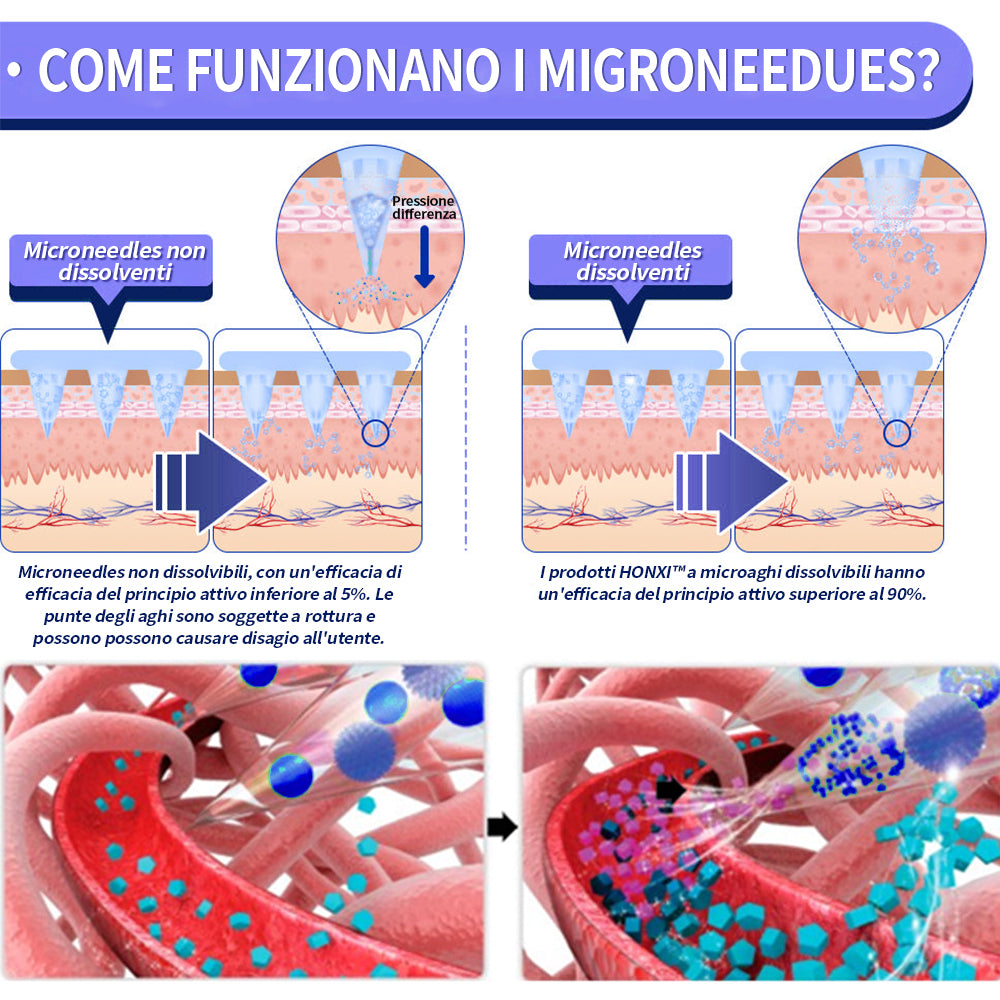 HonXi® SMGT-GLP-1 cerotto nano microneedle (⏰Tempo limitato 80% di sconto - Ultimi 30 minuti)