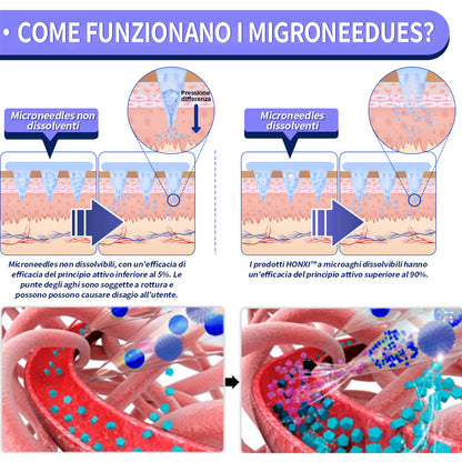 HonXi® SMGT-GLP-1 cerotto nano microneedle (⏰Tempo limitato 80% di sconto - Ultimi 30 minuti)